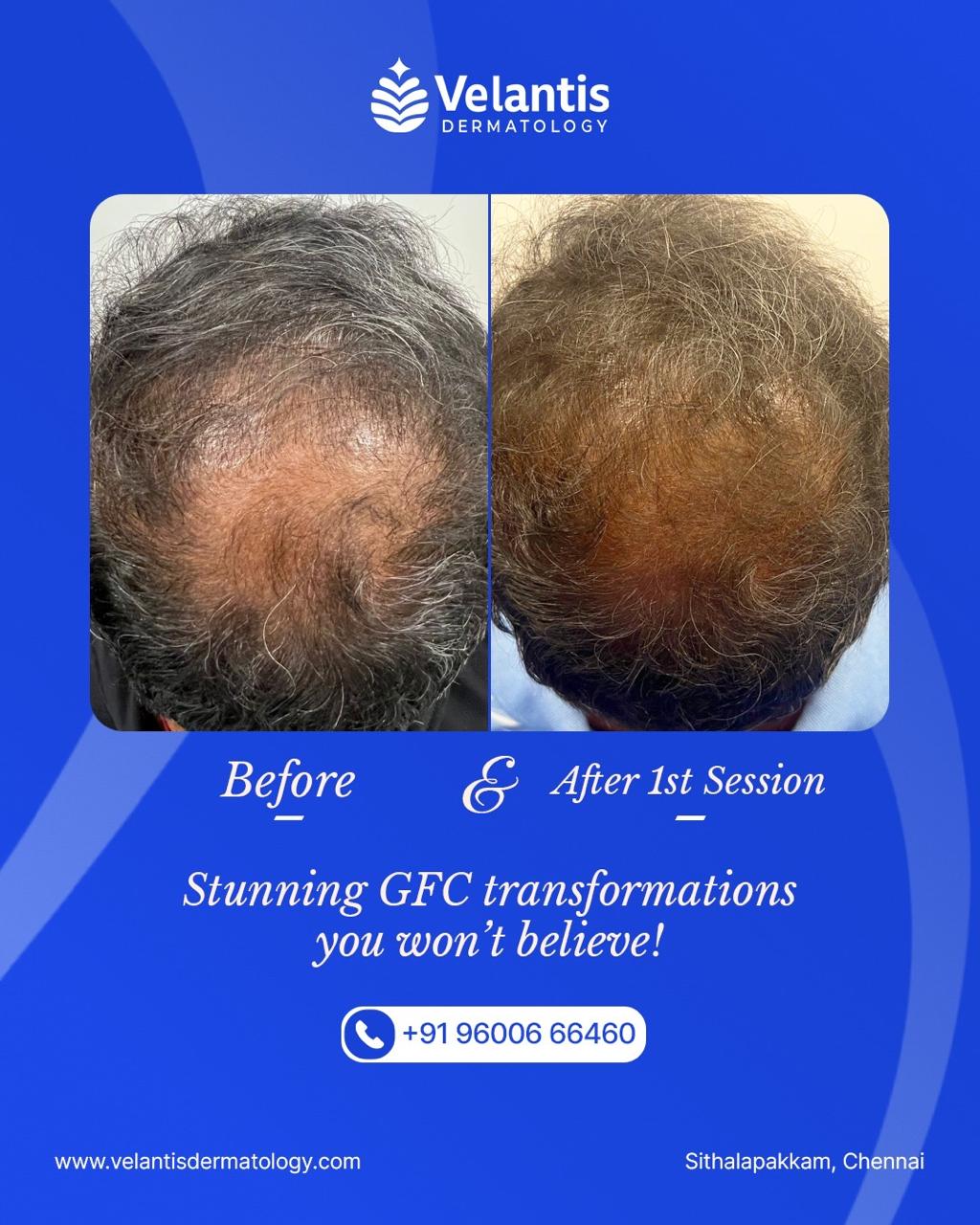 Velantis Dermatology Gallery
